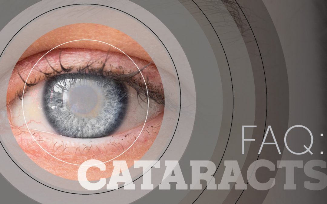 FAQ: Cataracts